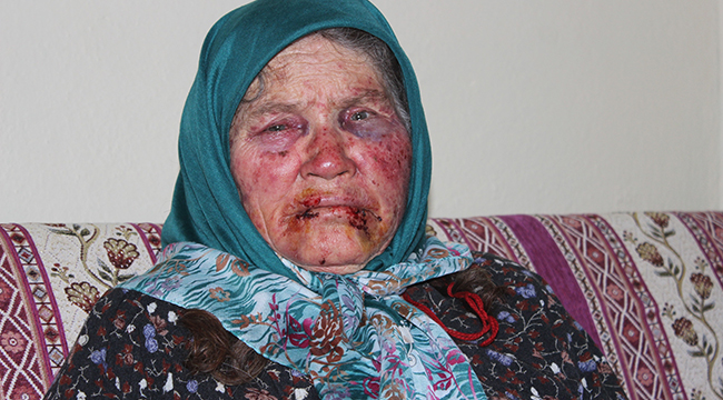 ÇAL’DA Kİ DARP OLAYINA 3 GÖZALTI
