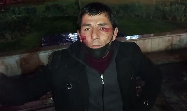 Tacize uğrayan kadını kurtarmak isterken az daha canından oluyordu