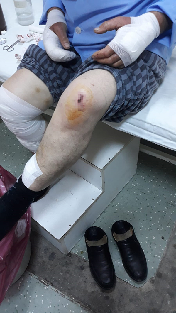 Denizli'de Dehşet Veren Görüntü Öldüresiye Dövdü