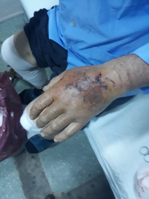 Denizli'de Dehşet Veren Görüntü Öldüresiye Dövdü