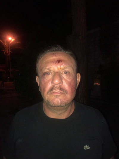Ali Çetin'in kavga görüntüleri basına yansıdı