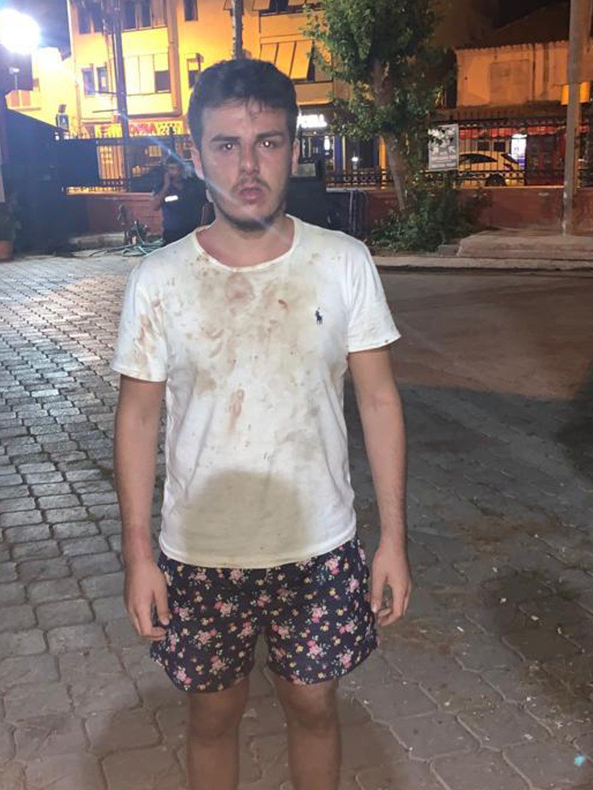 Ali Çetin'in kavga görüntüleri basına yansıdı