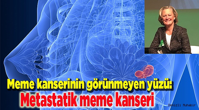 Metastatik meme kanseri