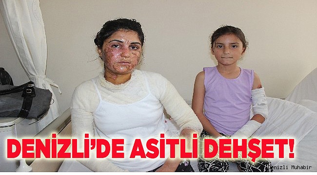 Denizli’de asitli dehşet