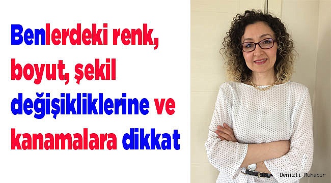 Benlerdeki renk, boyut, şekil değişikliklerine ve kanamalara dikkat