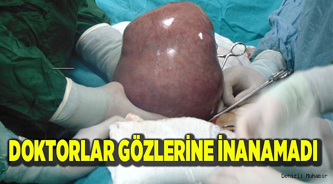 Karın ağrısı şikayetiyle gitti, rahminden 5 kilo ur çıktı
