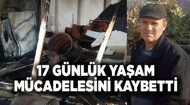 17 günlük yaşam mücadelesini kaybetti