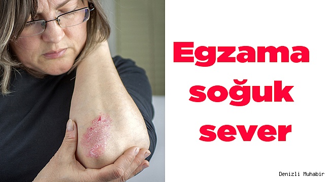 Egzama soğuk sever