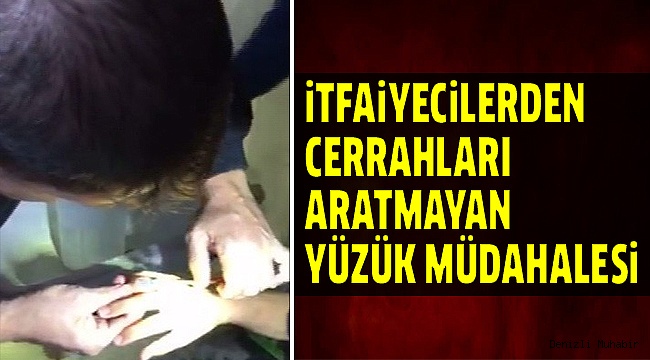 PARMAĞINA SIKIŞAN YÜZÜĞÜ İTFAİYE ÇIKARDI