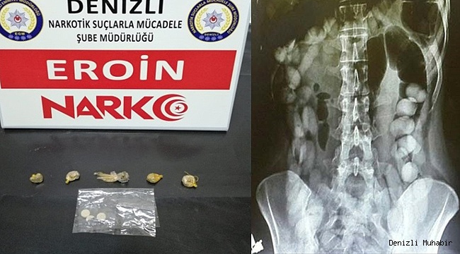 İran'dan Denizli'ye midesinde uyuşturucu getirdi