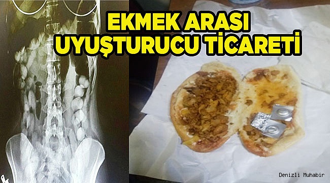 UYUMA Operasyonu: 17 TUTUKLAMA