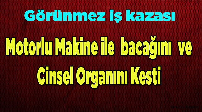 Motorlu Makine ile Cinsel Organını Kesti