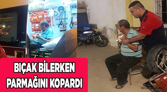 Bıçak bilerken parmağını kopardı