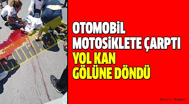 Denizli’de Feci Kaza :1 Yaralı