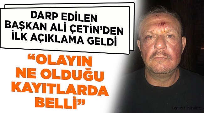 Bakın Olay Neden Çıkmış! İşte Başkan Çetin'in İlk Açıklamaları
