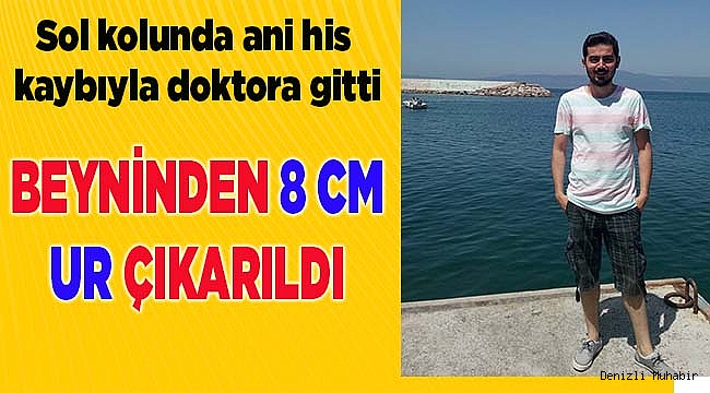 Tümör, uyuşma ve halsizlikle kendini gösterdi