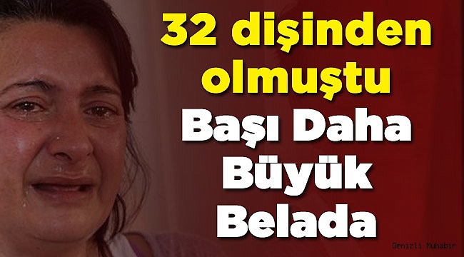 Tüm Dişlerini Kaybetmişti Şimdi ise...