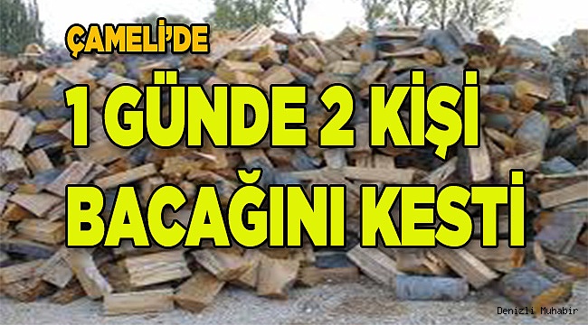 Denizli’de Motorlu Testere İle Bacaklarını Kestiler