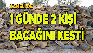 Denizli’de Motorlu Testere İle Bacaklarını Kestiler