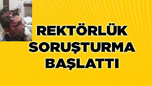 REKTÖR SORUŞTURMA AÇTI