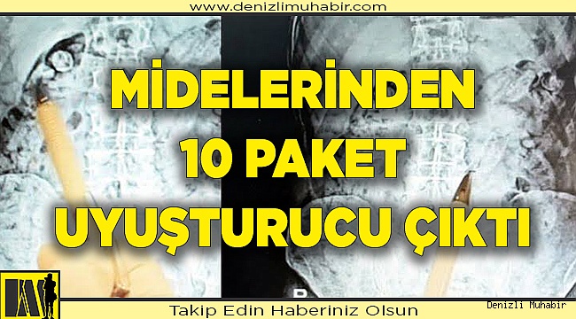 Midelerinden 100 Paket Uyuşturucu Çıktı