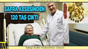 Safra kesesinden 120’ye yakın taş çıkarıldı