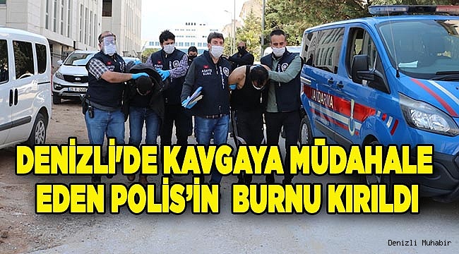 Denizli'de kavgaya müdahale eden polis memurunun burnu kırıldı