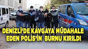 Denizli'de kavgaya müdahale eden polis memurunun burnu kırıldı