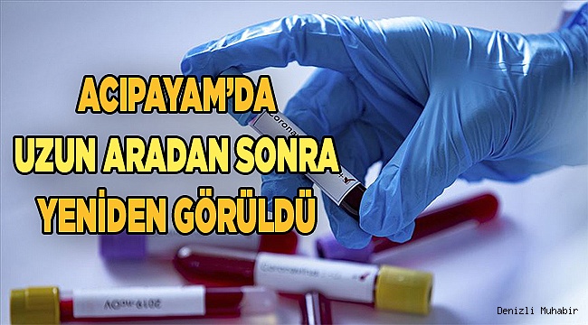 HAFTALARDIR VAKA ÇIKMIYORDU