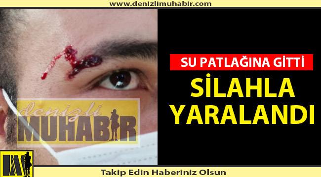 AZ DAHA GÖZÜNÜ KAYBEDİYORDU