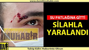 AZ DAHA GÖZÜNÜ KAYBEDİYORDU