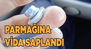 Parmağındaki 3 santimetrelik vidayla hastaneye koştu