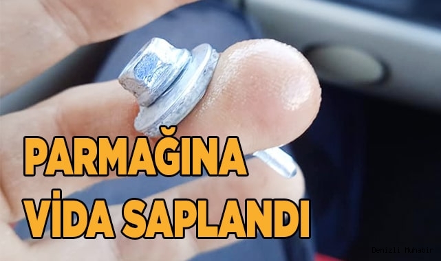 Parmağındaki 3 santimetrelik vidayla hastaneye koştu