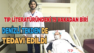 Tıp literatüründeki 19 vakadan biri, Denizli Tekden Hastanesi'nde tedavi edildi