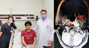 Duymamanızın sebebi geniz tümörü olabilir