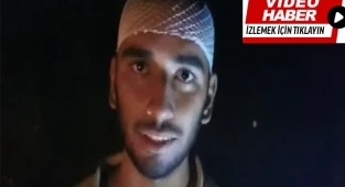 Kafasından yaralandı, yangını söndürmeye devam etti