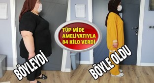 Tüp mide ameliyatıyla 84 kilo veren genç kız, hastalıklardan da kurtuldu