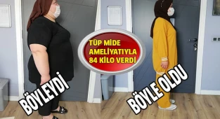 Tüp mide ameliyatıyla 84 kilo veren genç kız, hastalıklardan da kurtuldu