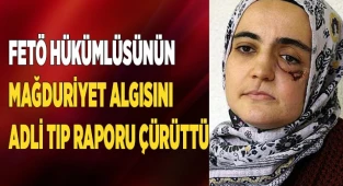 FETÖ hükümlüsünün mağduriyet algısını adli tıp raporu çürüttü