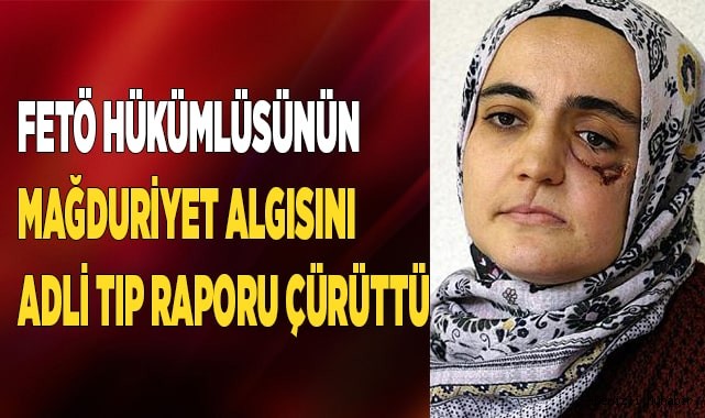 FETÖ hükümlüsünün mağduriyet algısını adli tıp raporu çürüttü