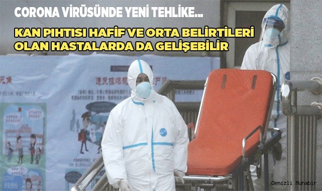 Kan pıhtısı hafif ve orta belirtileri olan hastalarda da gelişebilir