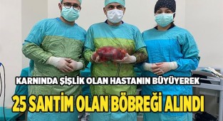 Büyüyerek  25 santim olan böbreği alındı