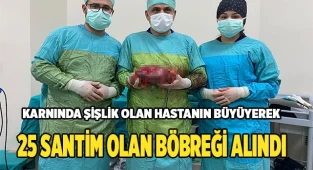 Büyüyerek  25 santim olan böbreği alındı