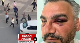 Eşinin memleketini tanımak isteyen gurbetçi, trafik magandalarının kurbanı oldu