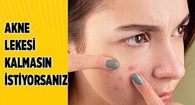 Akne Tedavisine İz ve Lekeler Oluşmadan Başlanmalı