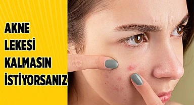 Akne Tedavisine İz ve Lekeler Oluşmadan Başlanmalı