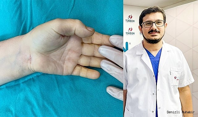 Bu ameliyat Denizli’de ilk defa  yapıldı