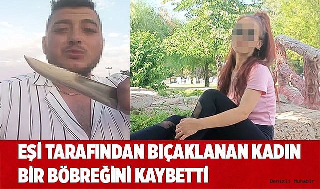 Eşi tarafından bıçaklanmıştı, böbreğini kaybetti