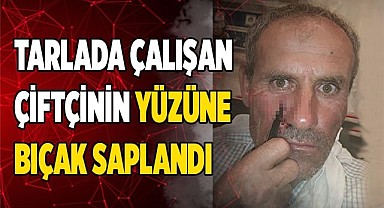 YÜZÜNDE BIÇAKLA ALTI SAAT BEKLEDİ
