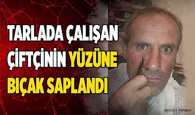 YÜZÜNDE BIÇAKLA ALTI SAAT BEKLEDİ